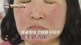 홍조와 기미 때문에 진한 화장을 해야 했던 사연자... | JTBC 240309 방송