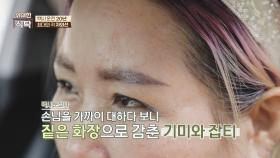 오랫동안 자외선에 노출된 그녀의 충격적인 피부 상태...💧 | JTBC 240413 방송