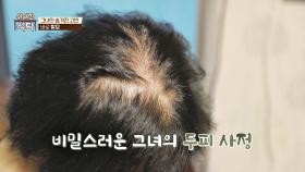 탈모로 인해 수치심까지 겪는다는 여성의 두피 상태💦 | JTBC 240511 방송