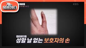 입질로 손가락 절단 위기?!😨 두부의 입질로 성할 날 없는 보호자의 손..😥 | KBS 240311 방송