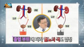 소변 색으로 보는 콩팥 건강! 당신의 소변, 정상이십니까?