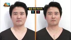 임호, 얼굴선 마사지로 무너진 얼굴 윤곽을 되찾다! #날렵미_소환