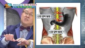 구부정한 등, 전신 건강을 무너뜨린다! 장기 건강 악화, 면역 저하까지!
