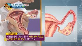 자궁 실제 크기는 달걀 하나?! 명의에게 듣는 여성의 자궁!