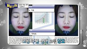 악건성에서 동안 피부 된 굿맨?! 맨얼굴로도 당당한 그녀의 이야기