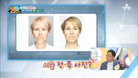 美人은 잠꾸러기! 잠이 보약이다! 잠이 부족하면 빨리 늙는다?!