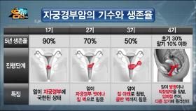 초기에는 사망률 10%, 말기엔 생존율 10%! 조기발견 어려운 자궁암!
