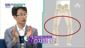 20대 퇴행성 관절염 환자가 증가하고 있다?! 연골을 지켜라!