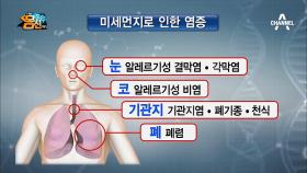 작은 크기로 깊숙하게!! [만성 염증 유발자] ②미세먼지!