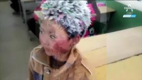 중국 울린 ‘눈송이 소년’…사진 한 장의 기적