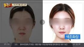 가짜 후기·조작 사진 내 건 성형외과