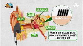 (충격!!) 난청을 부르는 원인! 출퇴근 필수품! '이어폰'?!