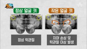 (냠냠) 얼굴키가 작으면 음식 씹기 어렵다?! (ft.치아건강 주의!)