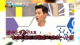 [예고] 악! 소리나는 요통의 진짜 이유, 짧아진 장요근?