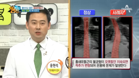 몸신이 설명하는 '흉쇄유돌근'! 흉쇄유돌근이 짧아지면, 목이 돌아간다고?!