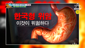 [예고] 위암발병률 세계 1위 한국! 한국형 위암이 따로 있다?