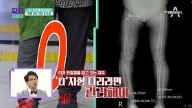 되돌리기 어려운 *관절 건강*! 나도 모르게 망가진 무릎 건강 Check List!