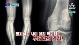 [예고] 일상을 망가뜨리는 퇴행성 관절염! 