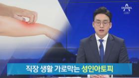 “회사 관두고 은둔까지”…직장 생활 가로막는 성인 아토피