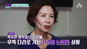 걷지 못할 뻔했던 그녀의 사연! 갑자기 찾아온 관절염의 공포