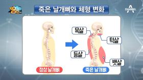 죽은 날개뼈는 뱃살-턱살-목살-등살 ※4종 세트※의 살을 불러온다?!