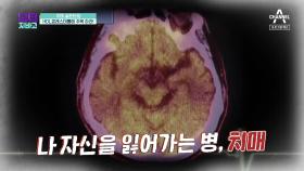 [예고] 치매 골든타임! 'HDL콜레스테롤'을 주목하라!