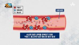 혈관 속 시한폭탄 '혈관 염증'이 생긴다?! 혈관 내피세포 이상이 부르는 문제!