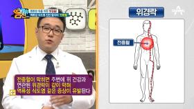 [위 건강 위한 혈자리 지압법] '전중혈'로 역류성 식도염을 진단할 수 있다...?