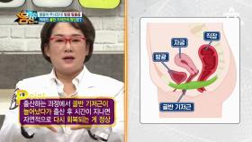 방광 탈출의 원인 '골반 기저근'이 약해지는 이유는?