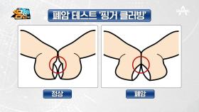 양 검지를 맞붙였을 때 다이아몬드 모양이 없으면 폐 질환을 의심해야 한다!