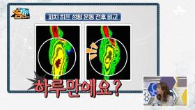 (동공확장) 피치 히프 성형 운동 20분 만에 보인 놀라운 결과