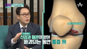 불편한 걸음걸이는 물론, 의자 없인 생활이 안된다? 3mm 무릎 연골의 중요성 '관절염'!