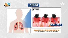 외부 물질로부터 폐를 보호하라! 몸속 보디가드 폐의 면역 과정은?