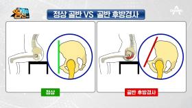 무심코 넘긴 나쁜 자세의 역습! 틀어진 골반 확인하기