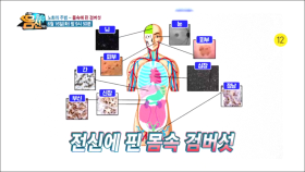 [예고] 노화의 주범, 내 몸속에 검버섯이 핀다!