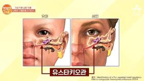 기상 직후 '머리'가 아픈 이유 ③비염-면역력 저하