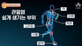 비가 오면 유독 무릎이 아픈 이유는?