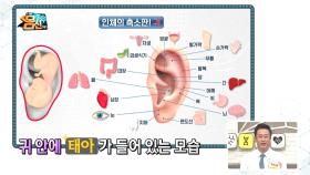 인체의 축소판 