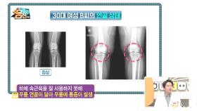 나도 모르는 사이 닳아버린 무릎 관절... 통증을 잡기 위해선 '내전근'을 키워라!?