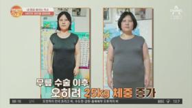 무릎 수술 이후 25kg 체중 증가...