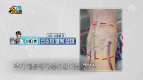 태권도 이다빈 선수, 심각한 발목 부상을 안고 올림픽에 출전하다?!