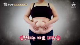 [예고] 21세기 신종 전염병이 또 나타났다?! 비만이 전염되는 이유는?