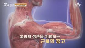 자연스러운 노화가 아닌 질병, 근감소증의 위험성은?