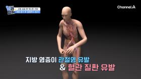 주체할 수 없는 식탐과 복부비만! 