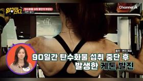 90일 간의 탄수화물 섭취 중단으로 생긴 