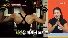 독한 다이어트 성공 후... 거뭇거뭇해진 등과 팔?! 심각한 피부질환으로 고생한 원인은?