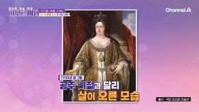 장내 환경 파괴로 고생했던 앤 여왕! 그녀가 비만이 된 사연은?