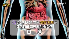 대장암 위험을 같이 높이는 위암, 위장 건강은 어떻게 잡아야할까?