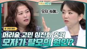 //머리숱 고민 심진화 충격// 모자가 탈모의 원인이 될 수 있다?! | tvN 201230 방송