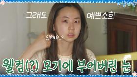 웃긴데 안쓰러운 상황...ㅠㅠ 웰컴(?) 모기에 부어버린 소희의 눈 | tvN 200911 방송
